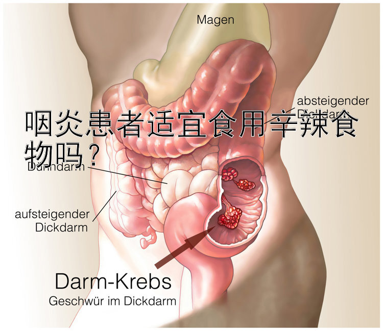 咽炎患者适宜食用辛辣食物吗？