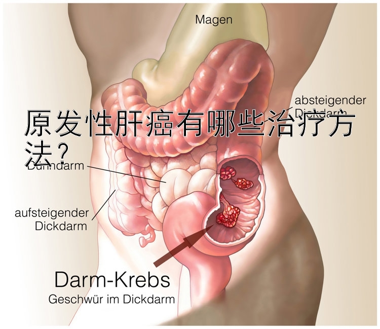 原发性肝癌有哪些治疗方法？