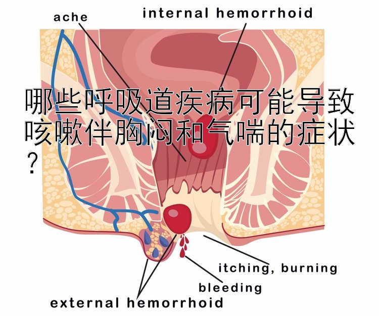 哪些呼吸道疾病可能导致咳嗽伴胸闷和气喘的症状？