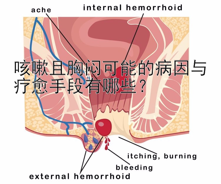 咳嗽且胸闷可能的病因与疗愈手段有哪些？