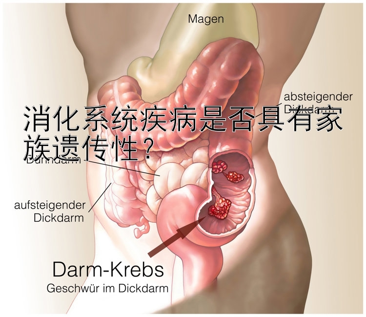 消化系统疾病是否具有家族遗传性？