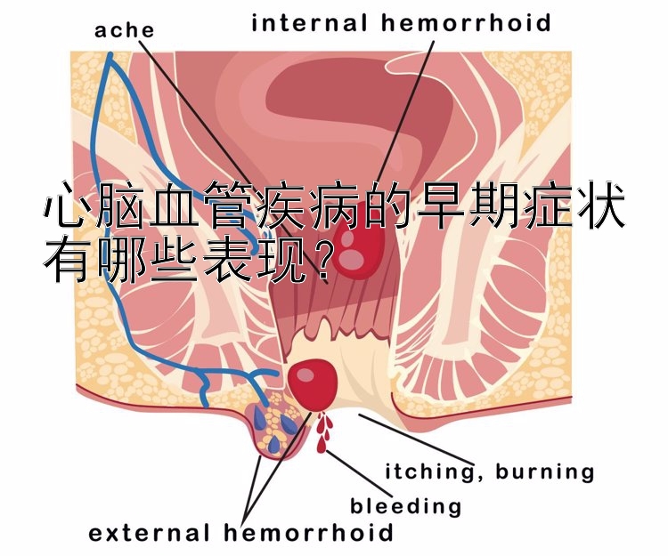 心脑血管疾病的早期症状有哪些表现？