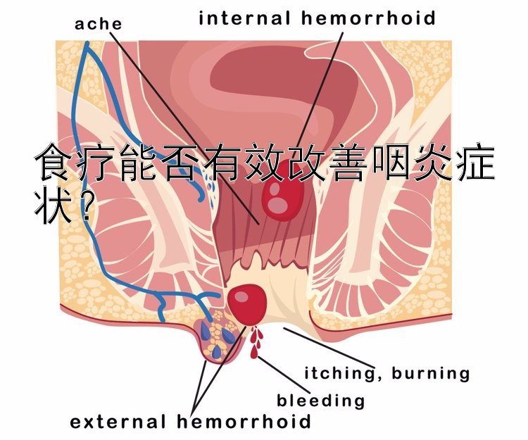 食疗能否有效改善咽炎症状？