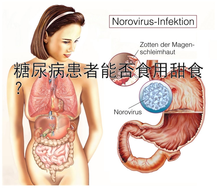 糖尿病患者能否食用甜食？