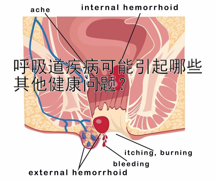 呼吸道疾病可能引起哪些其他健康问题？