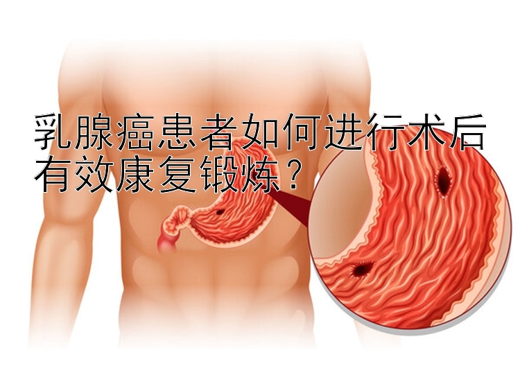 乳腺癌患者如何进行术后有效康复锻炼？