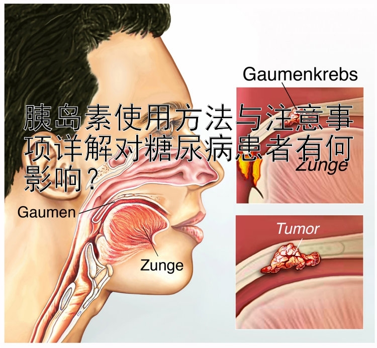 胰岛素使用方法与注意事项详解对糖尿病患者有何影响？