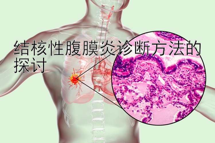 结核性腹膜炎诊断方法的探讨