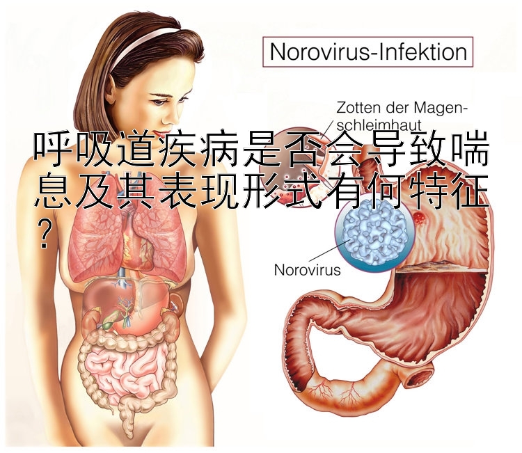 呼吸道疾病是否会导致喘息及其表现形式有何特征？