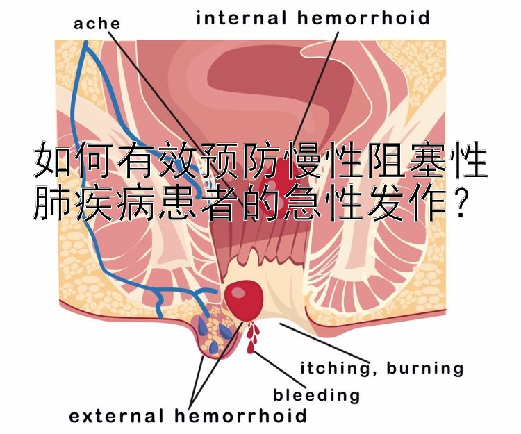 如何有效预防慢性阻塞性肺疾病患者的急性发作？