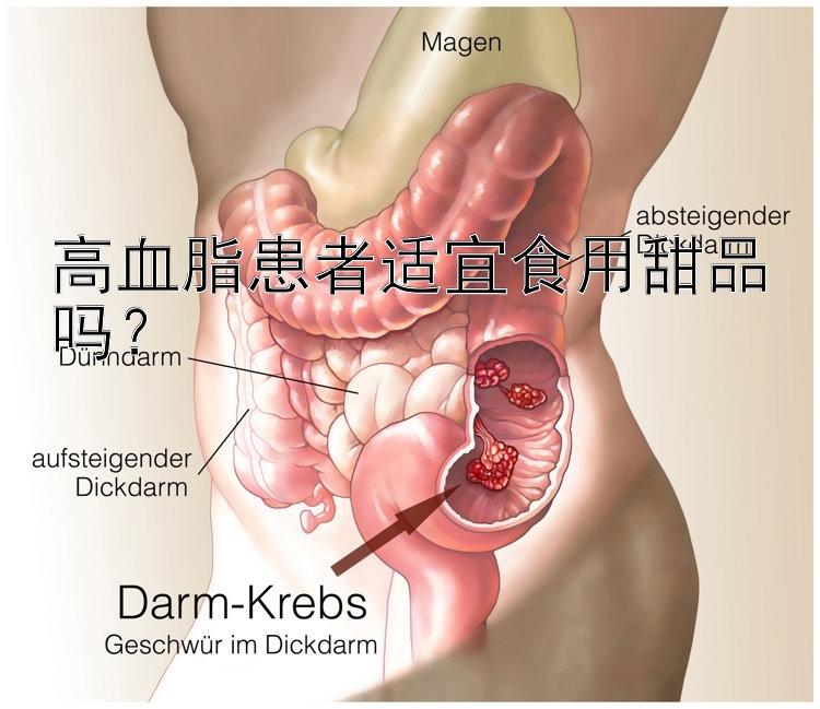 高血脂患者适宜食用甜品吗？