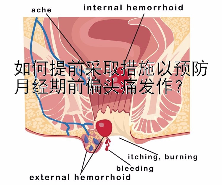 幸运飞艇 如何提前采取措施以预防月经期前偏头痛发作？