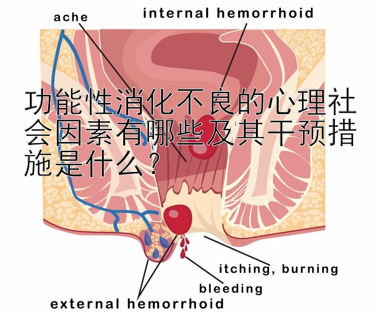 功能性消化不良的心理社会因素有哪些及其干预措施是什么？