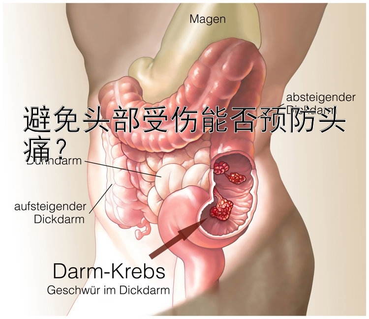 避免头部受伤能否预防头痛？