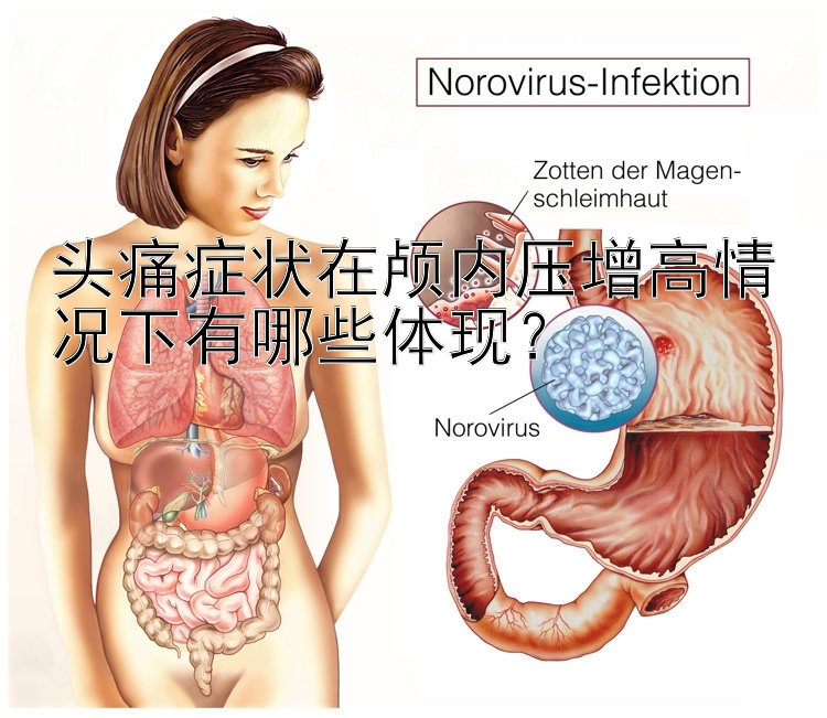 头痛症状在颅内压增高情况下有哪些体现？