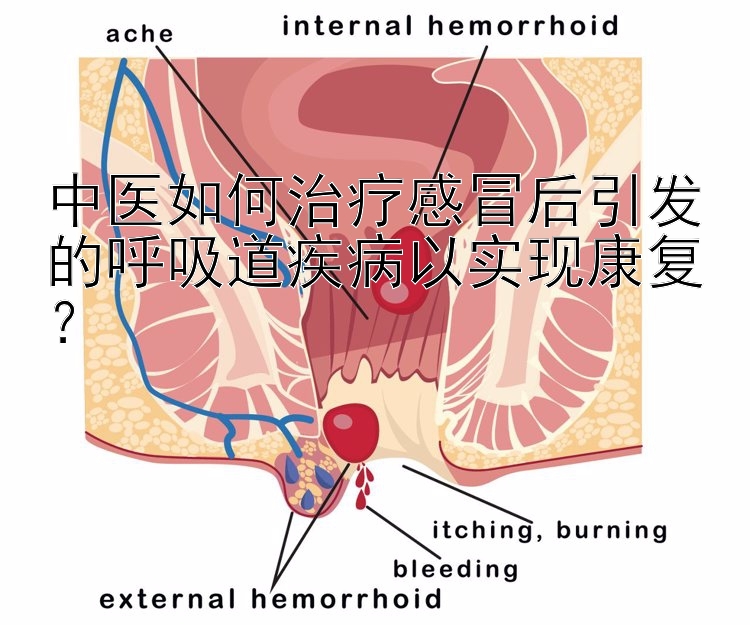 中医如何治疗感冒后引发的呼吸道疾病以实现康复？