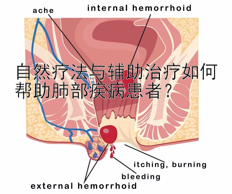 自然疗法与辅助治疗如何帮助肺部疾病患者？