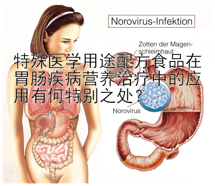 特殊医学用途配方食品在胃肠疾病营养治疗中的应用有何特别之处？