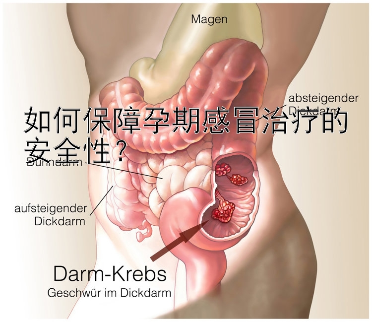 乐发彩神官方邀请码 如何保障孕期感冒治疗的安全性？