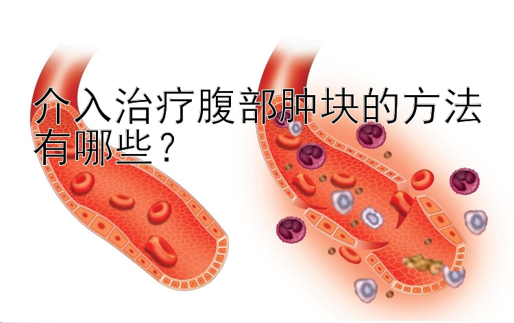 介入治疗腹部肿块的方法有哪些？