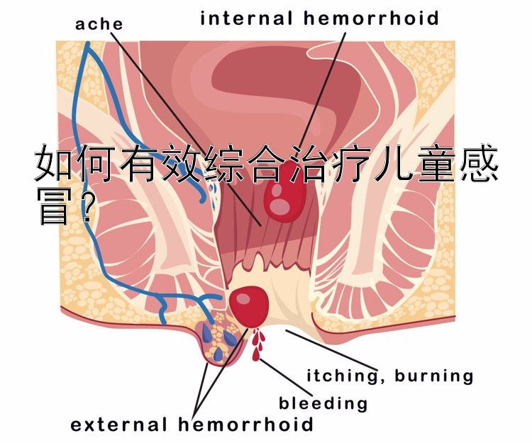 如何有效综合治疗儿童感冒？