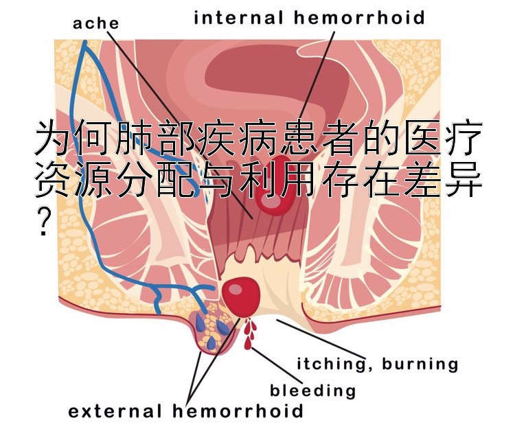 为何肺部疾病患者的医疗资源分配与利用存在差异？