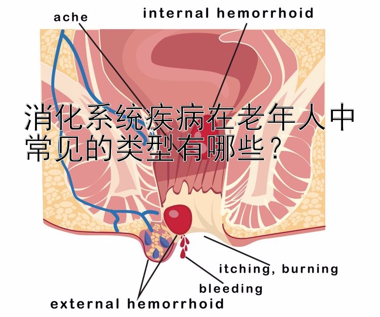 消化系统疾病在老年人中常见的类型有哪些？