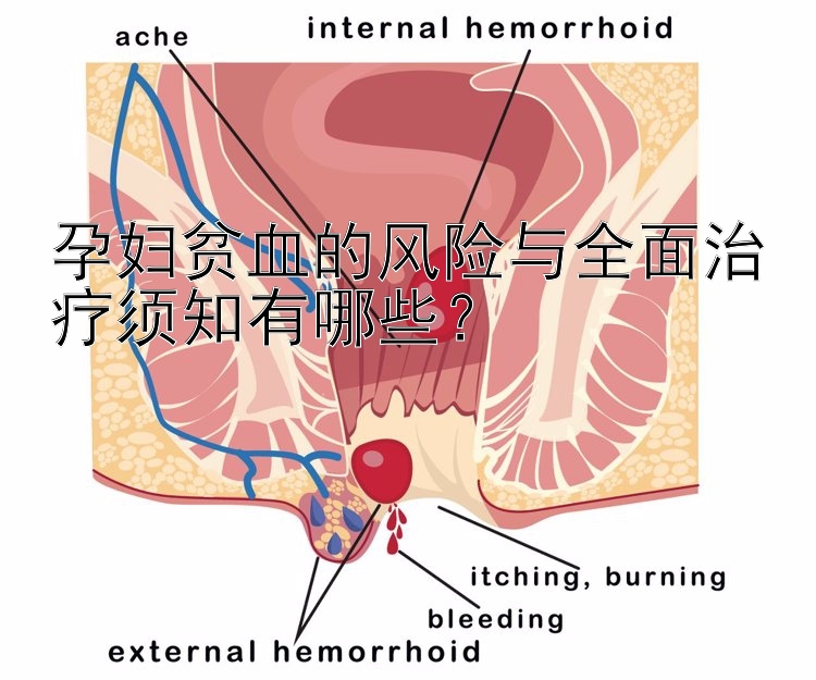 孕妇贫血的风险与全面治疗须知有哪些？