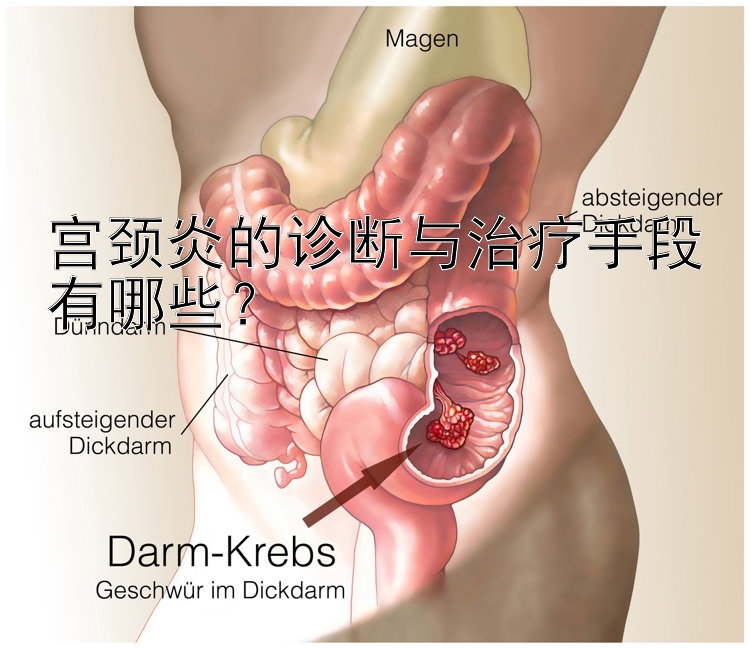 宫颈炎的诊断与治疗手段有哪些？