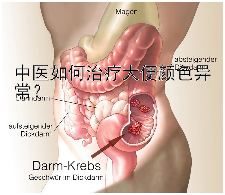 中医如何治疗大便颜色异常？