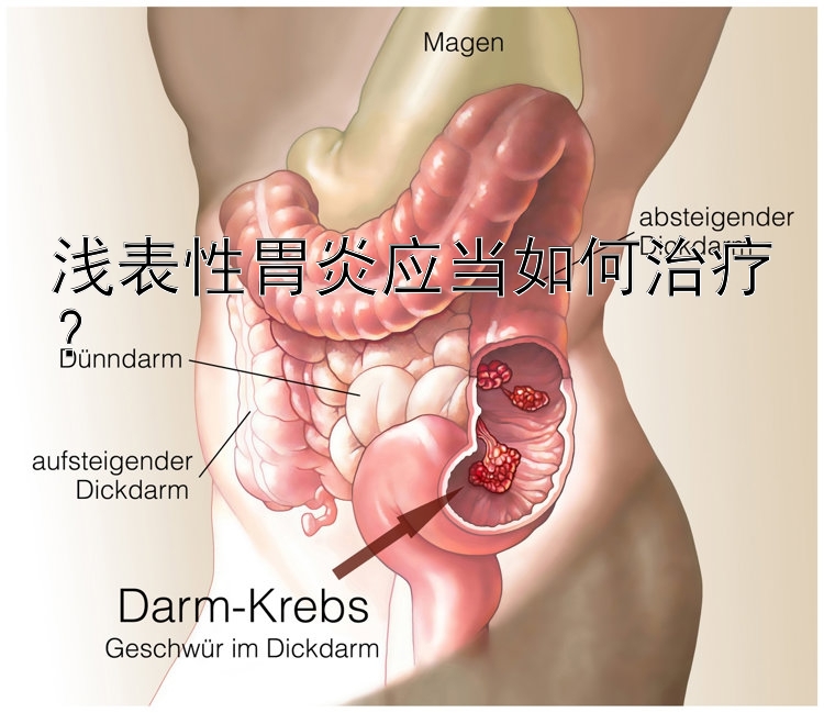 浅表性胃炎应当如何治疗？