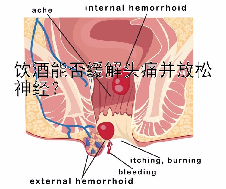 饮酒能否缓解头痛并放松神经？