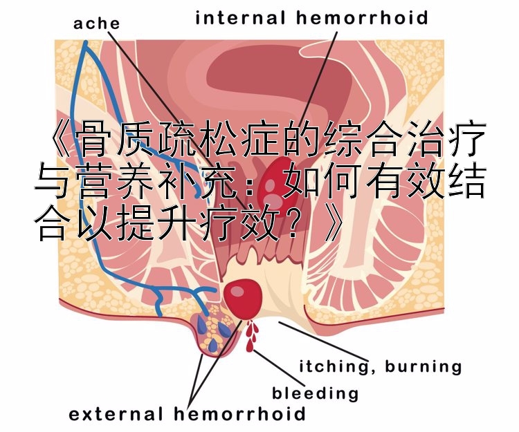 《骨质疏松症的综合治疗与营养补充：如何有效结合以提升疗效？》