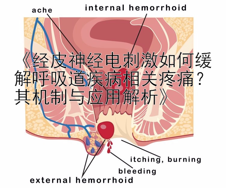 《经皮神经电刺激如何缓解呼吸道疾病相关疼痛？其机制与应用解析》