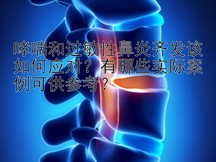 哮喘和过敏性鼻炎齐发该如何应对？有哪些实际案例可供参考？