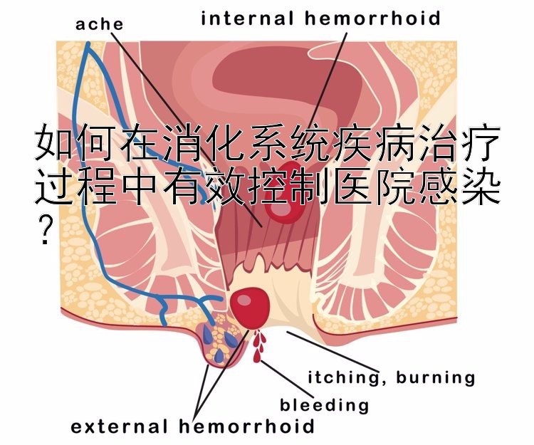 如何在消化系统疾病治疗过程中有效控制医院感染？