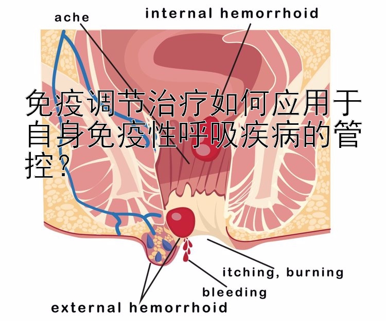 免疫调节治疗如何应用于自身免疫性呼吸疾病的管控？