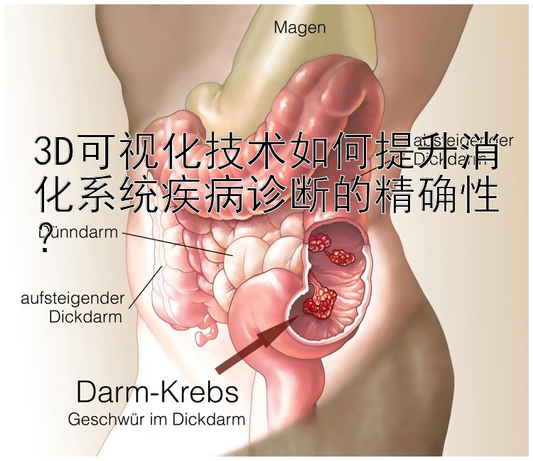 3D可视化技术如何提升消化系统疾病诊断的精确性？